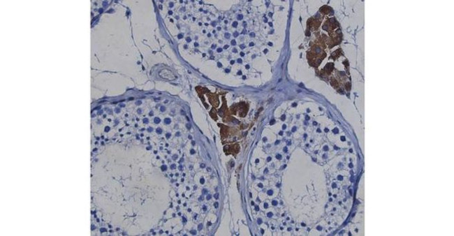 MERTK Antibody in Immunohistochemistry (Paraffin) (IHC (P))
