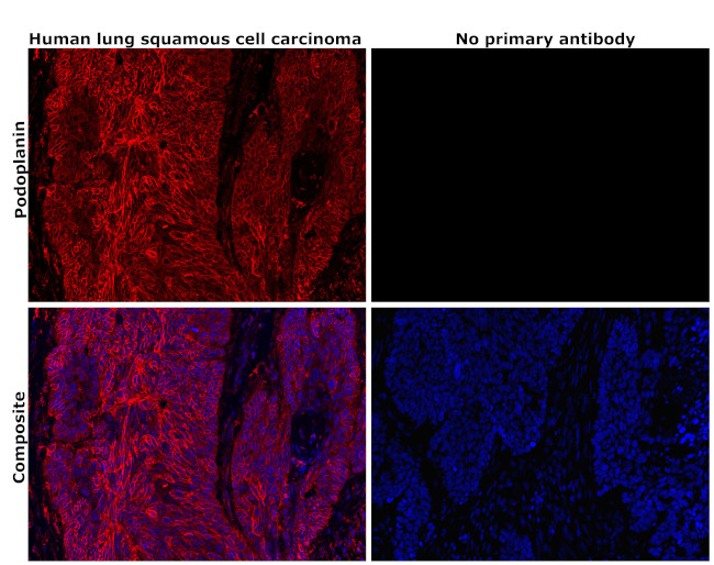 Podoplanin Antibody in Immunohistochemistry (Paraffin) (IHC (P))