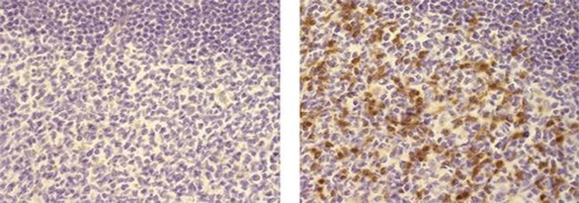 ITK Antibody in Immunohistochemistry (Paraffin) (IHC (P))