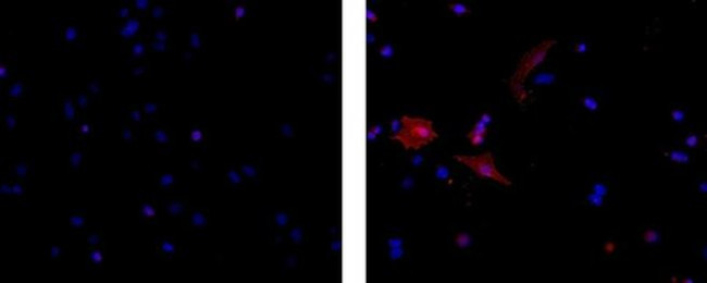 Disialoganglioside GD3 Antibody in Immunocytochemistry (ICC/IF)