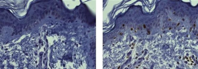 RUNX3 Antibody in Immunohistochemistry (Paraffin) (IHC (P))