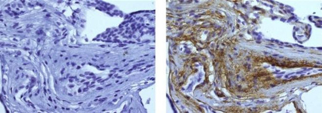 Collagen IV Antibody in Immunohistochemistry (Paraffin) (IHC (P))
