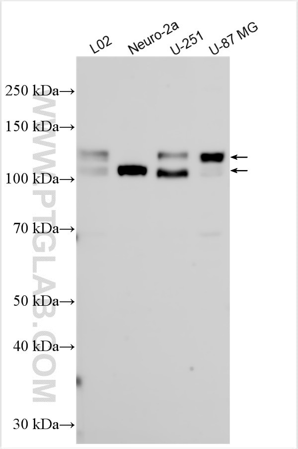 PCDH8 Antibody in Western Blot (WB)