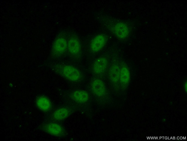 NFKBIZ Antibody in Immunocytochemistry (ICC/IF)