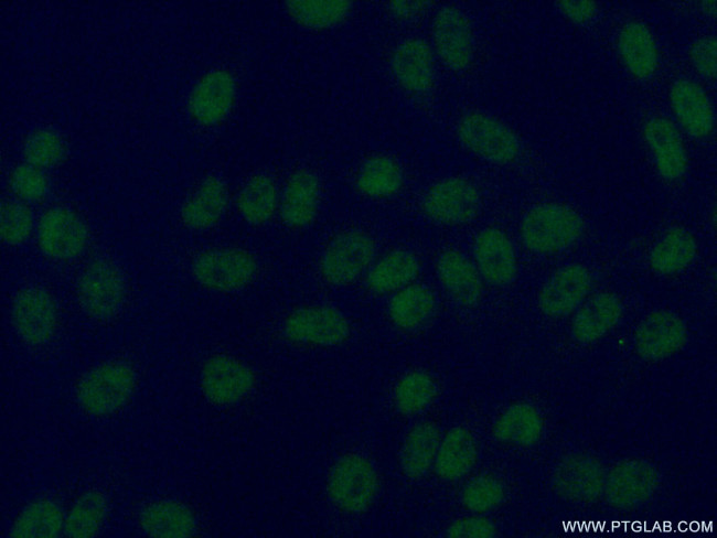 STAG1 Antibody in Immunocytochemistry (ICC/IF)