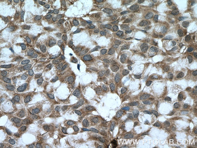BACH1 Antibody in Immunohistochemistry (Paraffin) (IHC (P))