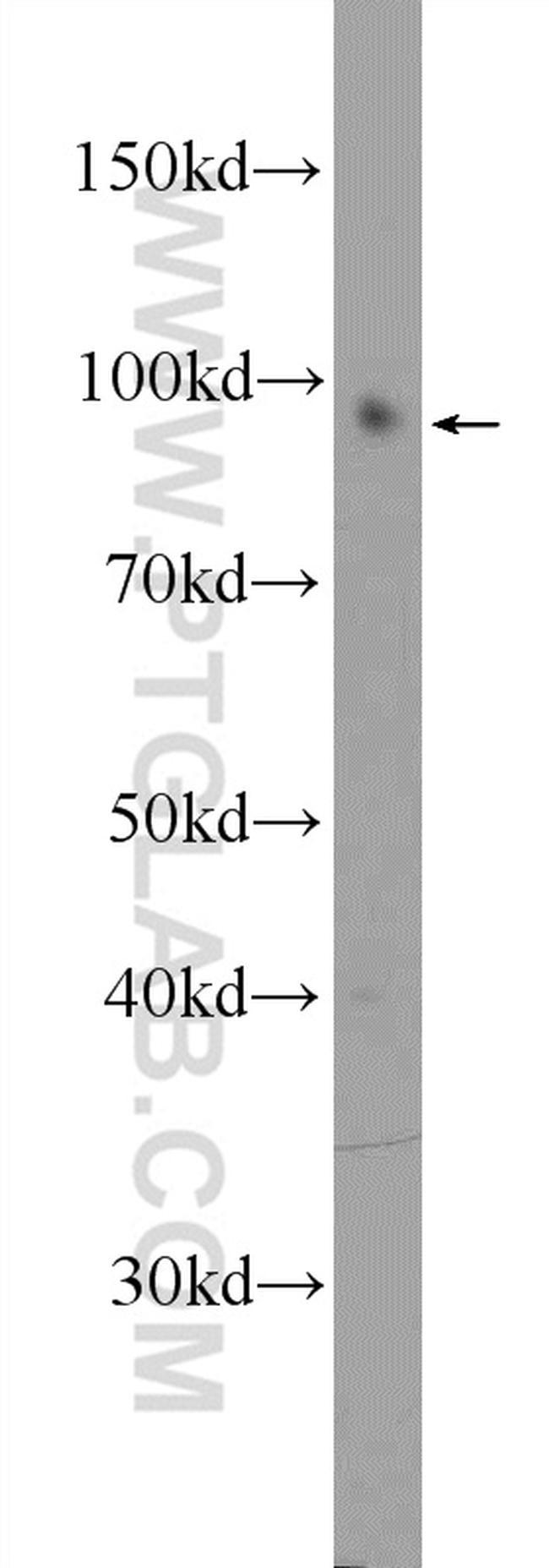 MYO1D Antibody in Western Blot (WB)