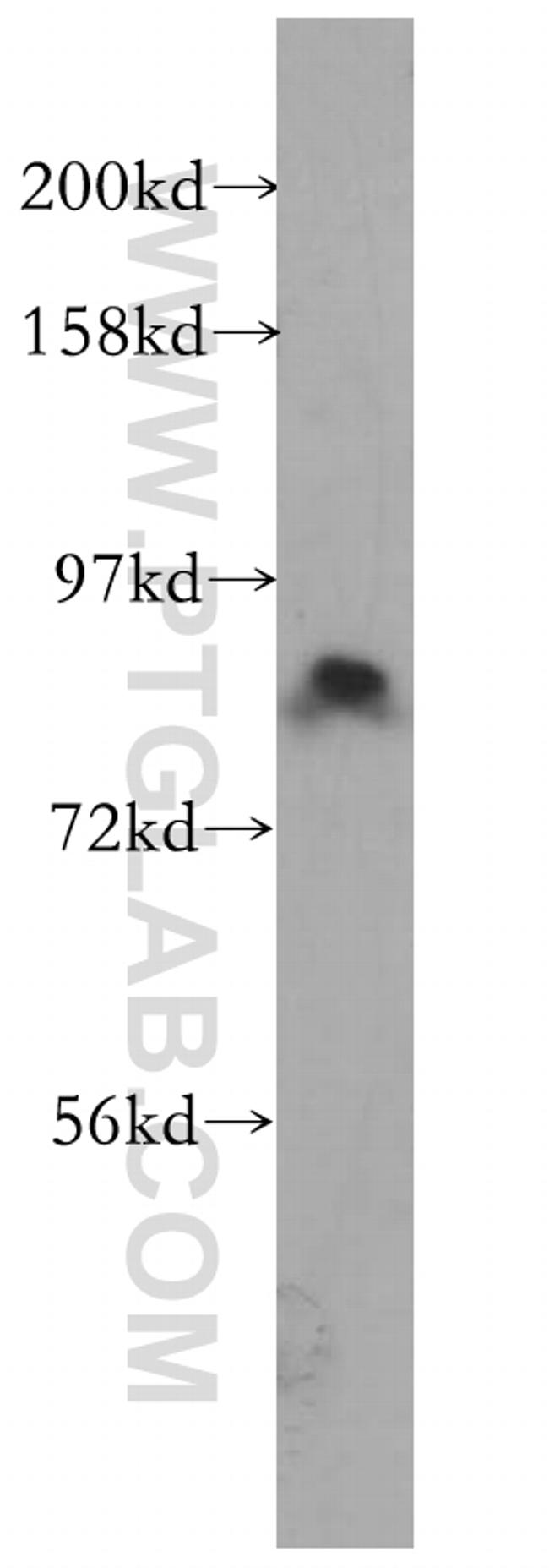 ACAP2 Antibody in Western Blot (WB)