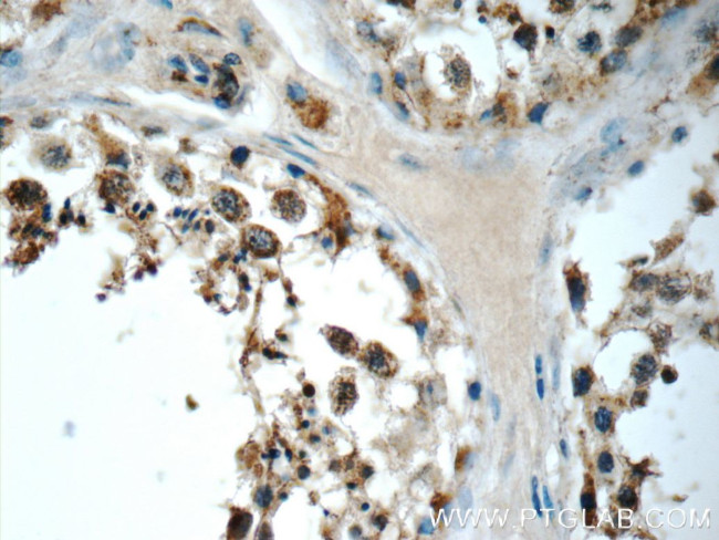 SCRG1 Antibody in Immunohistochemistry (Paraffin) (IHC (P))