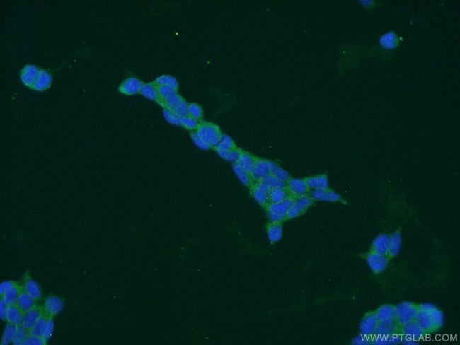 HLCS Antibody in Immunocytochemistry (ICC/IF)
