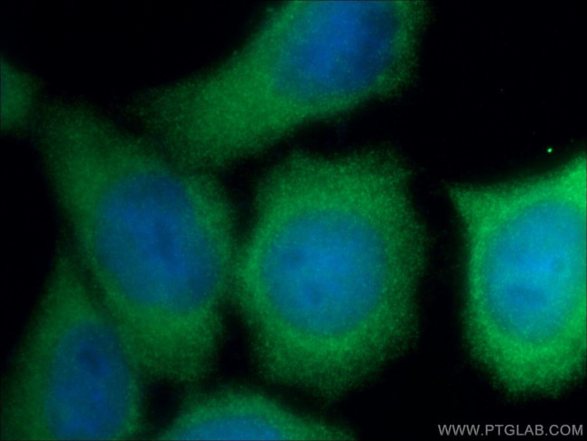 CDK6 Antibody in Immunocytochemistry (ICC/IF)