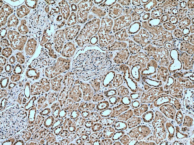 USP16 Antibody in Immunohistochemistry (Paraffin) (IHC (P))