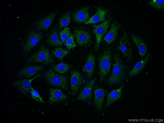 RGS7 Antibody in Immunocytochemistry (ICC/IF)