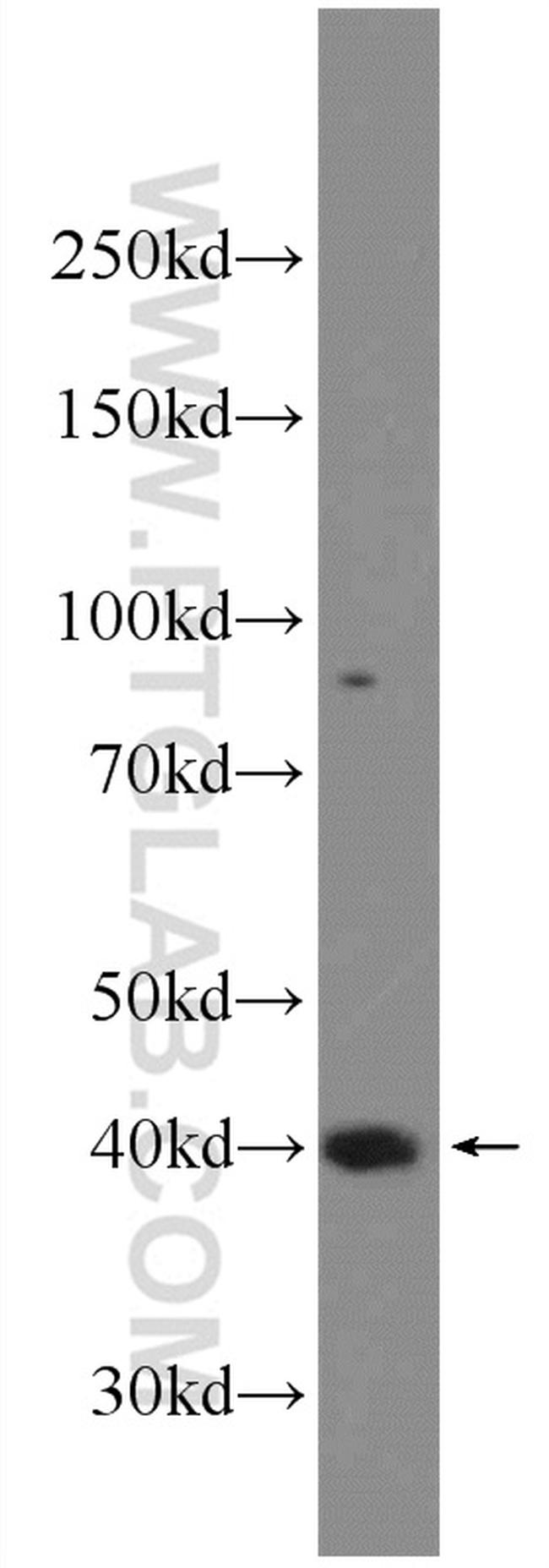 SETD8 Antibody in Western Blot (WB)