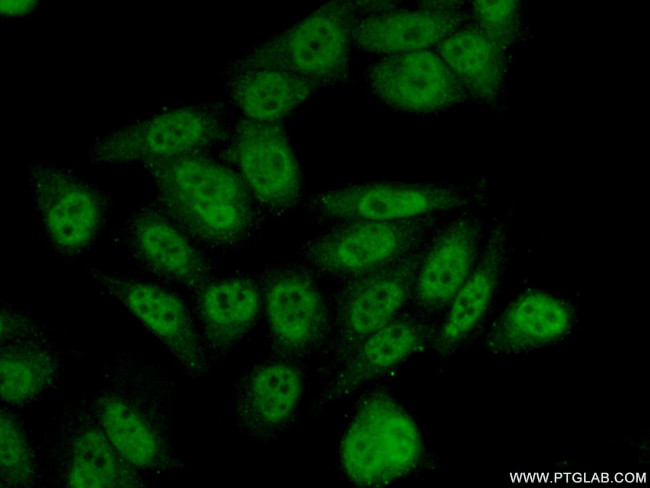 INTS5 Antibody in Immunocytochemistry (ICC/IF)