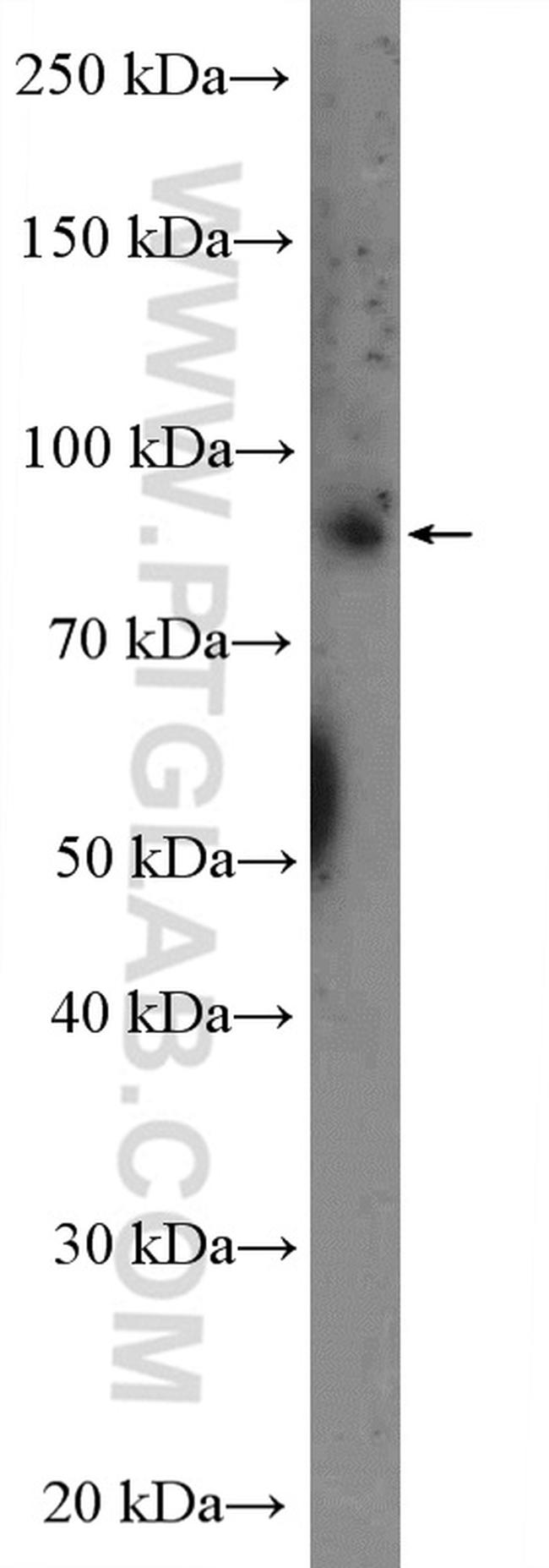 L3MBTL3 Antibody in Western Blot (WB)