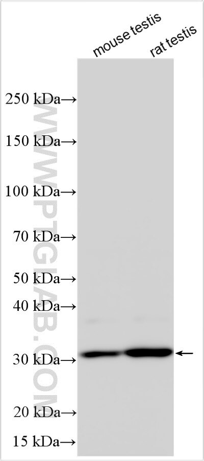 GNPTG Antibody in Western Blot (WB)