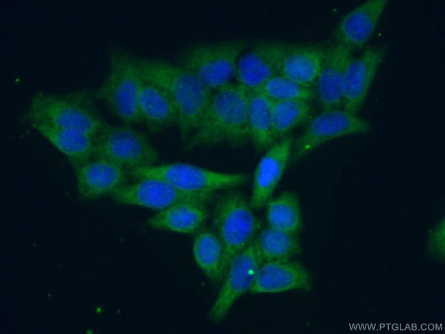 UBE2R2 Antibody in Immunocytochemistry (ICC/IF)