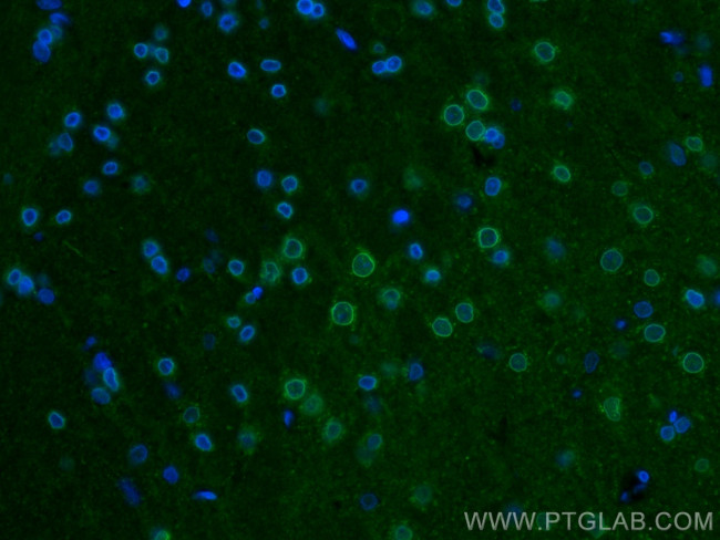 Kv1.3 Antibody in Immunohistochemistry (PFA fixed) (IHC (PFA))