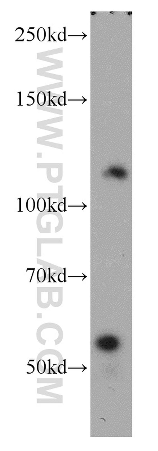 MORC1 Antibody in Western Blot (WB)