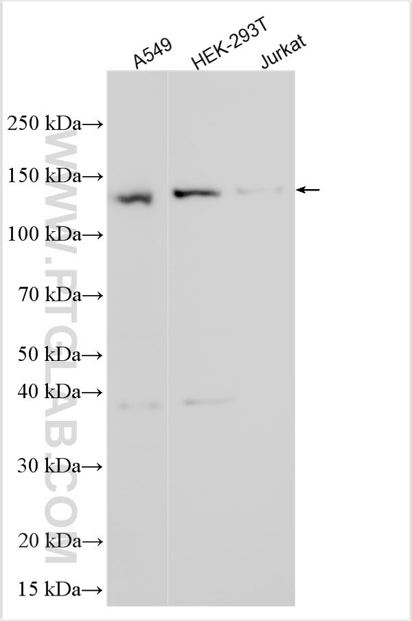 TSSK6 Antibody in Western Blot (WB)