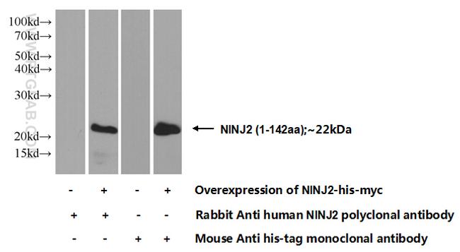 NINJ2 Antibody in Western Blot (WB)