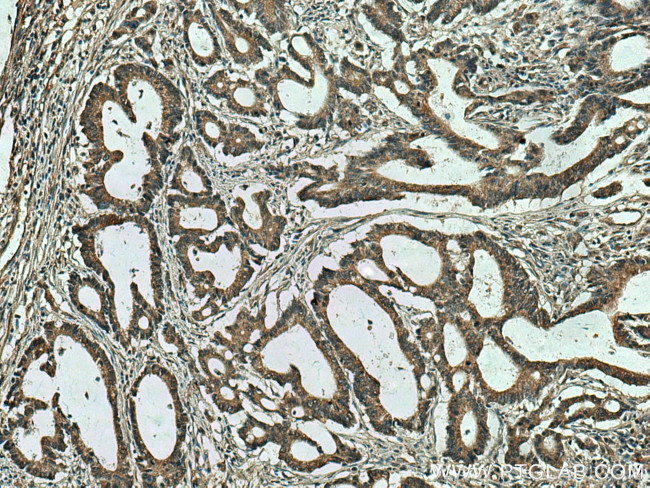 SLC5A11 Antibody in Immunohistochemistry (Paraffin) (IHC (P))