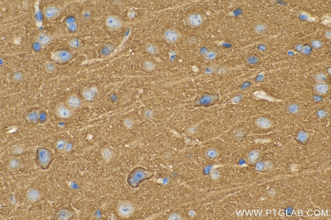 SNAP91 Antibody in Immunohistochemistry (Paraffin) (IHC (P))