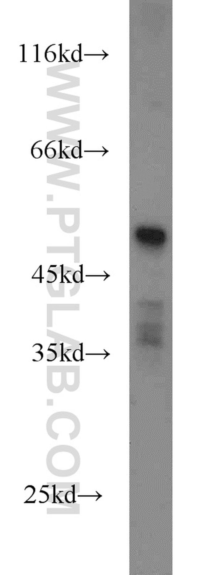 HTRA4 Antibody in Western Blot (WB)