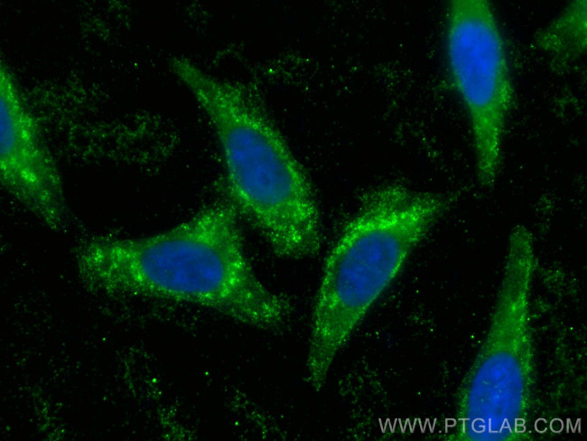 ASAP3 Antibody in Immunocytochemistry (ICC/IF)