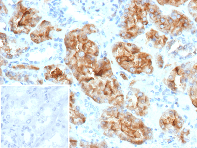 Crystallin Alpha B/CRYAB (Marker of Metaplastic Carcinoma) Antibody in Immunohistochemistry (Paraffin) (IHC (P))