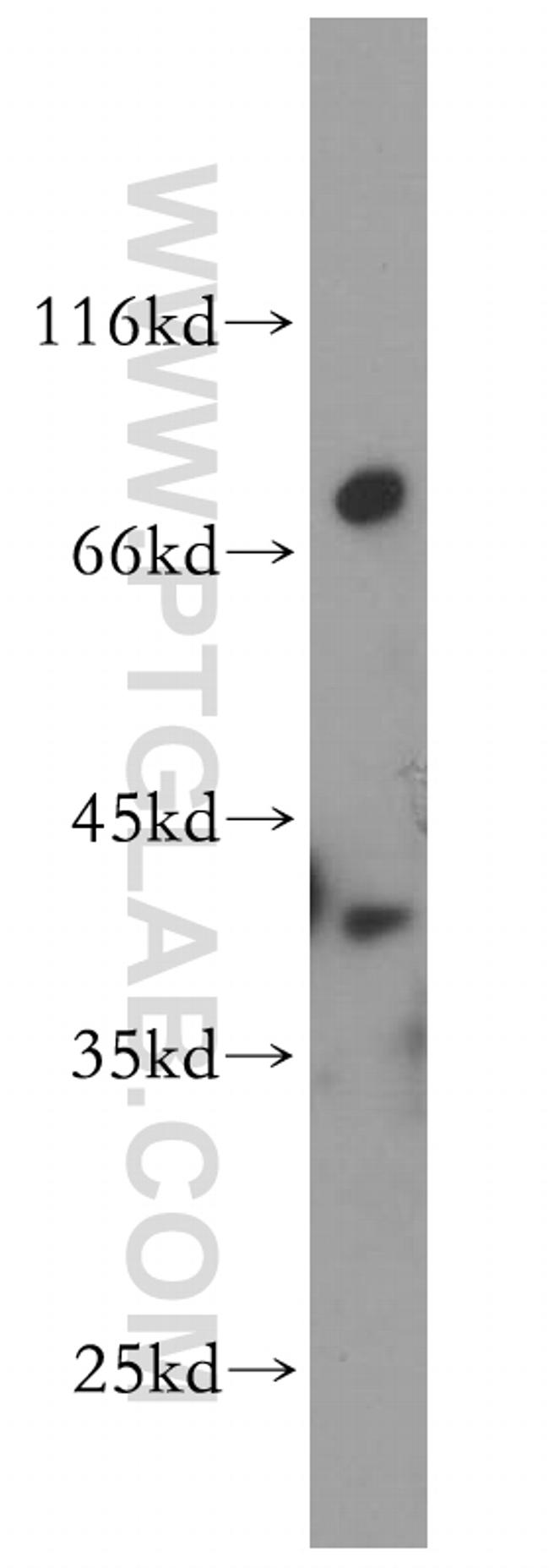 DOK6 Antibody in Western Blot (WB)