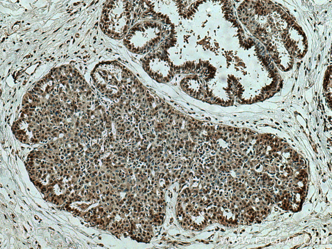 SEPHS2 Antibody in Immunohistochemistry (Paraffin) (IHC (P))