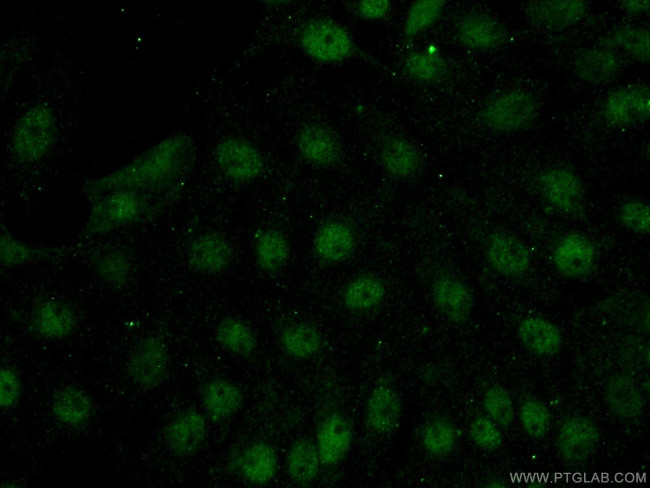 FOXR2 Antibody in Immunocytochemistry (ICC/IF)
