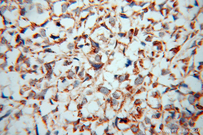 ATP5J Antibody in Immunohistochemistry (Paraffin) (IHC (P))