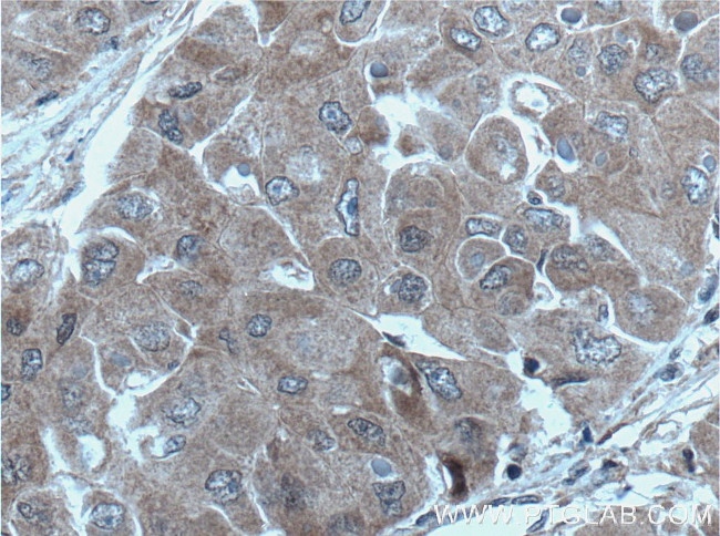 UBE2S Antibody in Immunohistochemistry (Paraffin) (IHC (P))