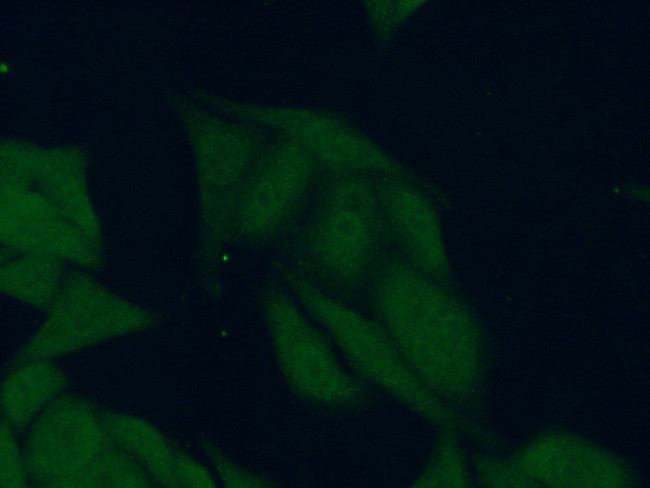 RPL17 Antibody in Immunocytochemistry (ICC/IF)