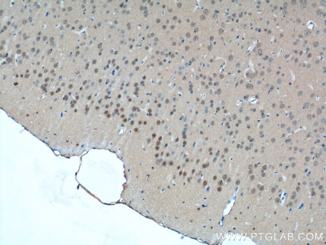 CDC26 Antibody in Immunohistochemistry (Paraffin) (IHC (P))