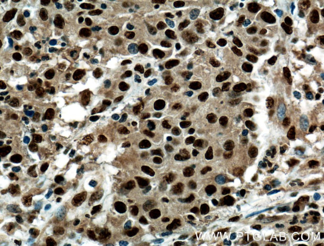 PRDM5 Antibody in Immunohistochemistry (Paraffin) (IHC (P))