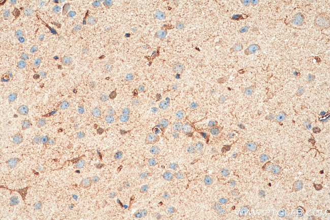 APC4 Antibody in Immunohistochemistry (Paraffin) (IHC (P))