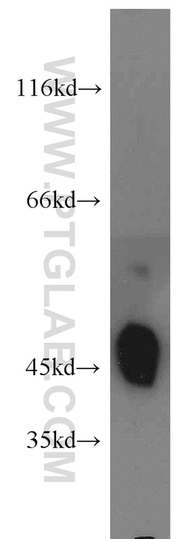 Kir2.2 Antibody in Western Blot (WB)