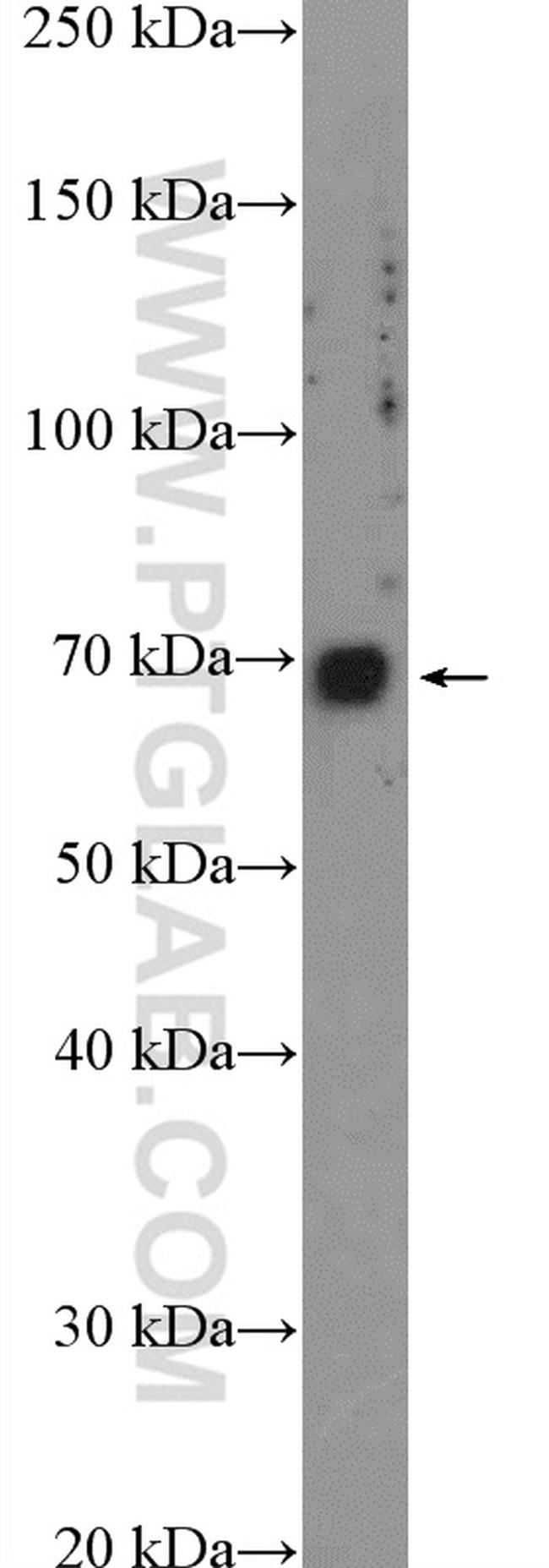 KCNK5 Antibody in Western Blot (WB)