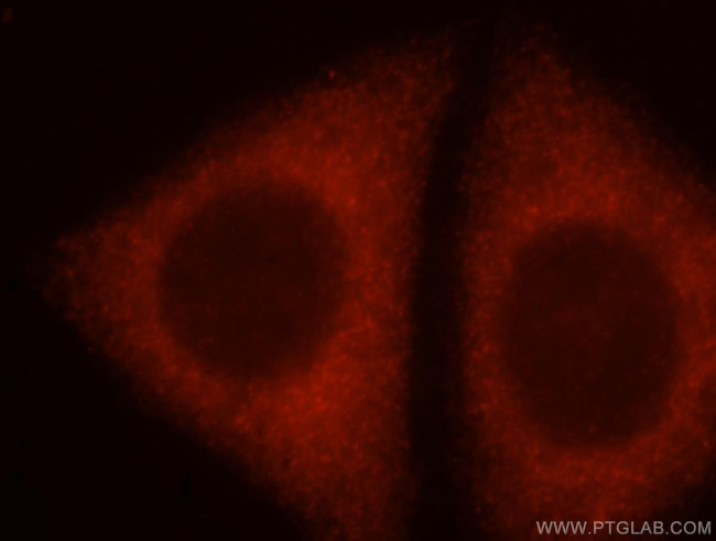 ADAM12 Antibody in Immunocytochemistry (ICC/IF)