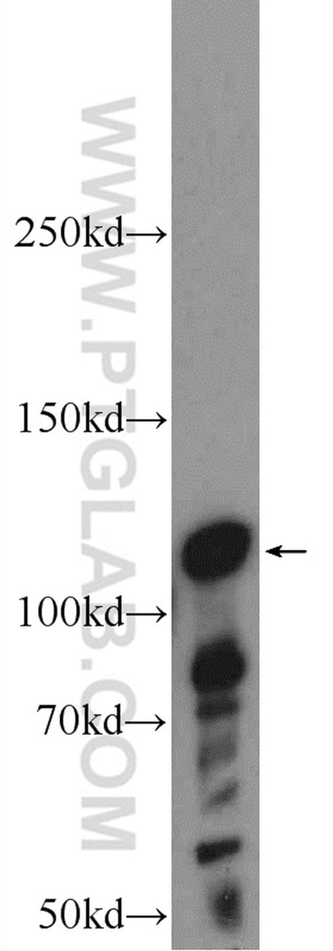STK31 Antibody in Western Blot (WB)