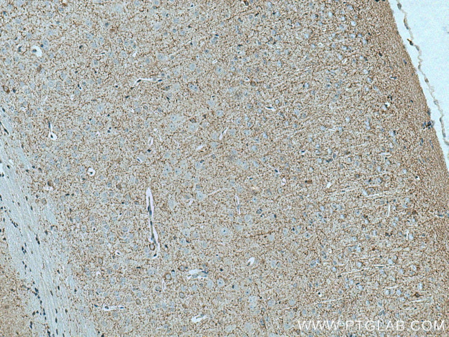 Synaptoporin Antibody in Immunohistochemistry (Paraffin) (IHC (P))