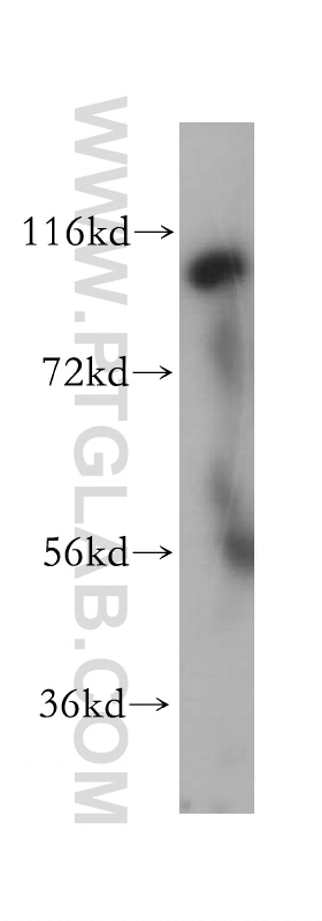 RASA3 Antibody in Western Blot (WB)