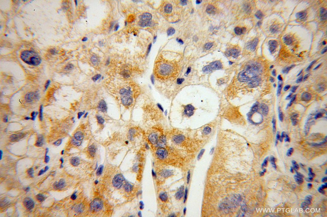 MIPOL1 Antibody in Immunohistochemistry (Paraffin) (IHC (P))