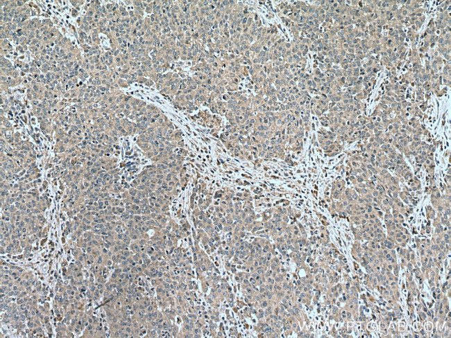 EBF1 Antibody in Immunohistochemistry (Paraffin) (IHC (P))
