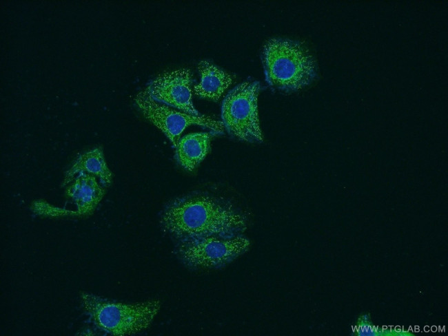SLC25A45 Antibody in Immunocytochemistry (ICC/IF)