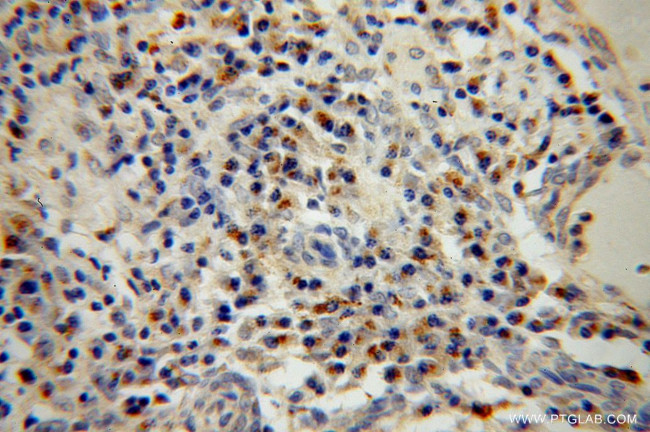 BET1L Antibody in Immunohistochemistry (Paraffin) (IHC (P))